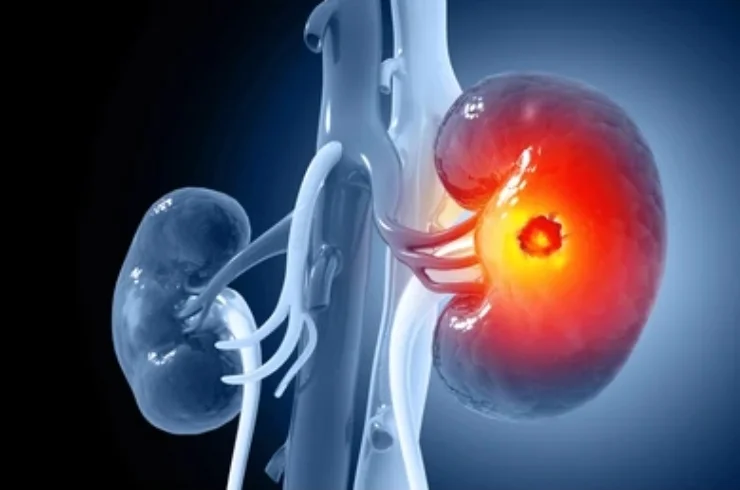 Urology care in Latur